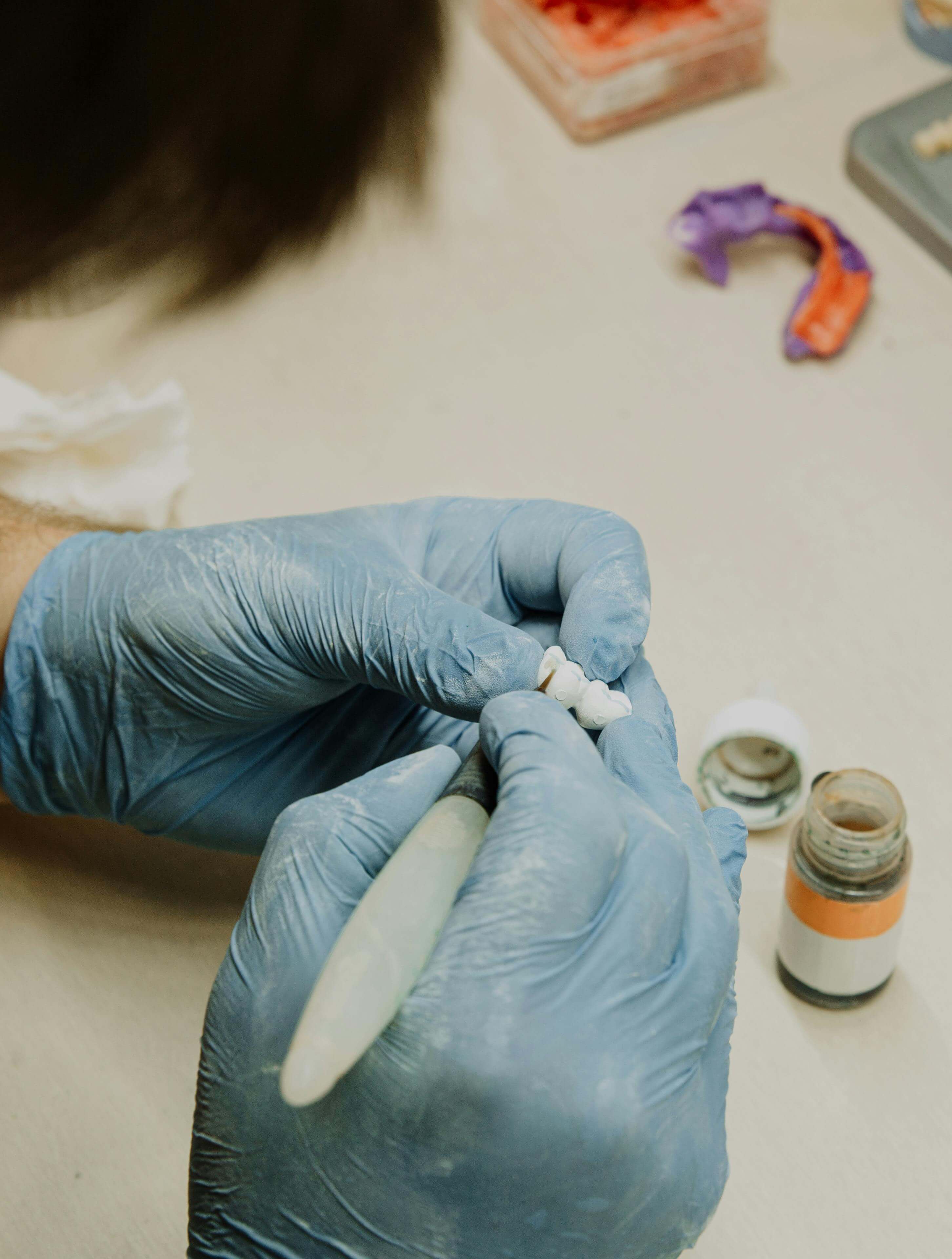 Corona dental sobre implante